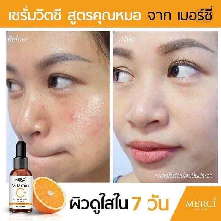 10x MERCI Vitamin C Extra Bright Serum Skin Smooth Facial Reduce Wrinkle 10ml