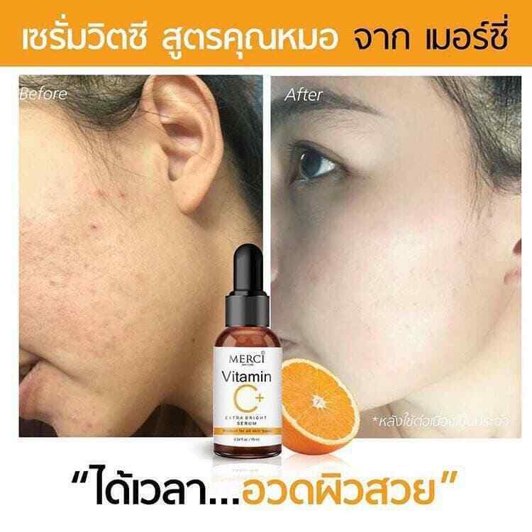 10x MERCI Vitamin C Extra Bright Serum Skin Smooth Facial Reduce Wrinkle 10ml