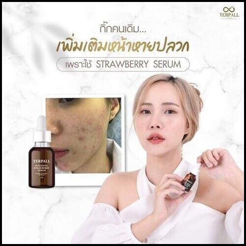 3x Serum Strawberry Yerpall Reduce Dark Spot tighten pores moist skin