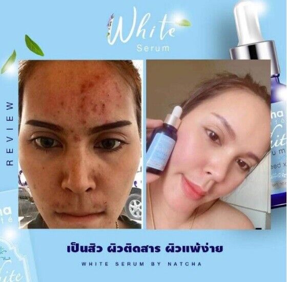 Duo Set Natcha White Serum&Rizda Soap Clear Face Brighten Anti Dull Skin Wrinkle