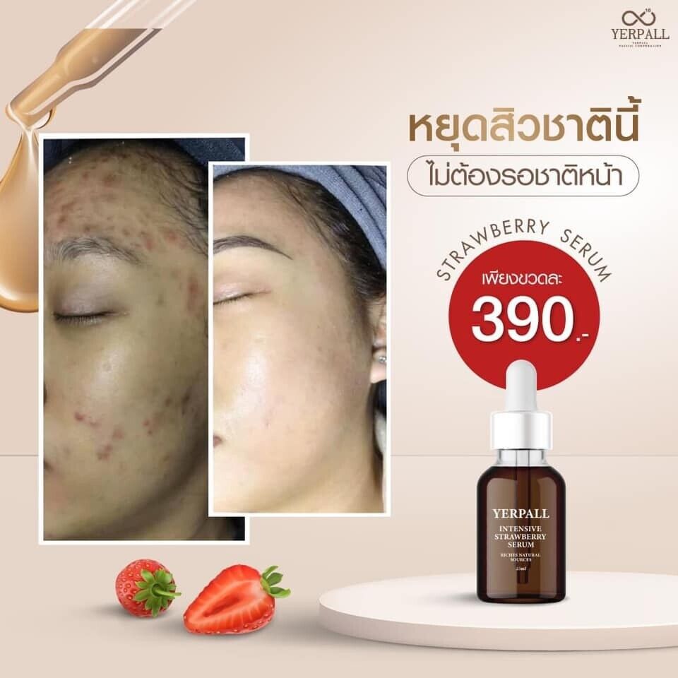 3x Serum Strawberry Yerpall Reduce Dark Spot tighten pores moist skin