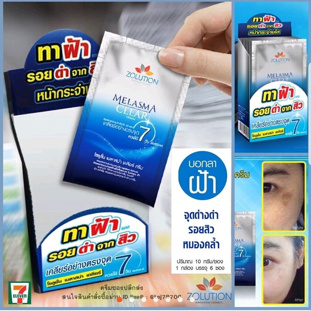 12x Zolution Melasma Clear Face Reduce Acne Scars Dark Spots Blemishes 10ml