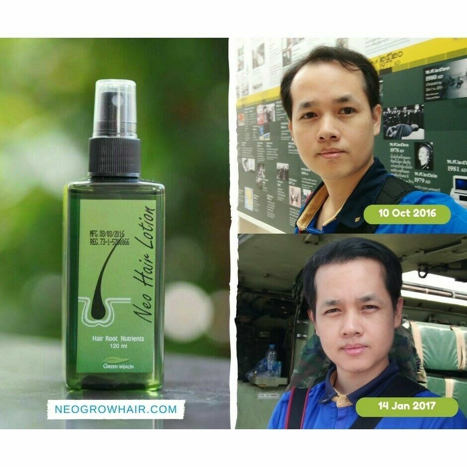 1X 120 ml. Green Wealth Neo Hair Lotion Root Nutrients Hair Loss Treatments