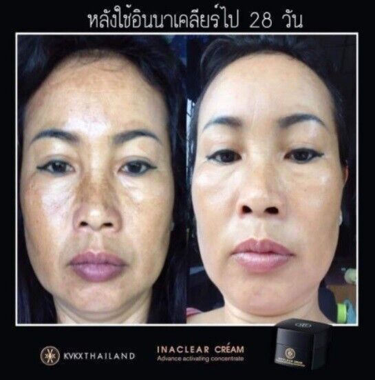Inaclear Face Cream rejuvenate Skin Healthy Smooth dark spots fade white clear
