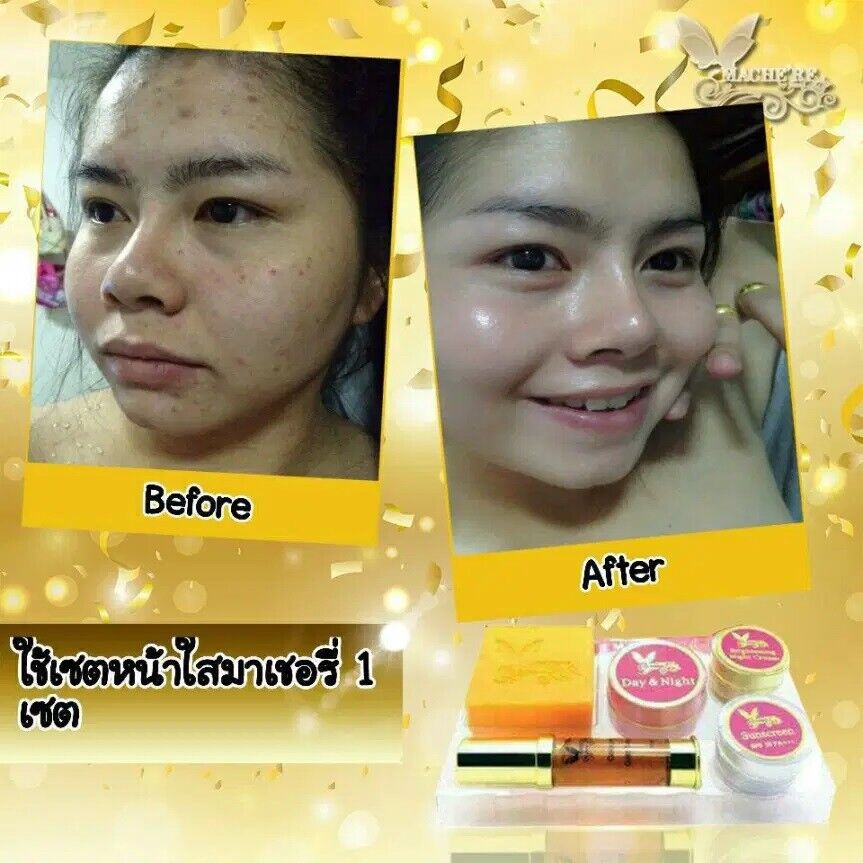 Mache're Gold Whitening Cream Perfect Set Bright Smooth Skin Face Care