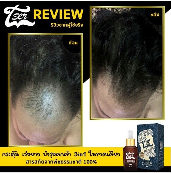 12X T-Ser Serum Nourish Growth Hair Eyebrows Mustache Beard Thicker Natural 100%