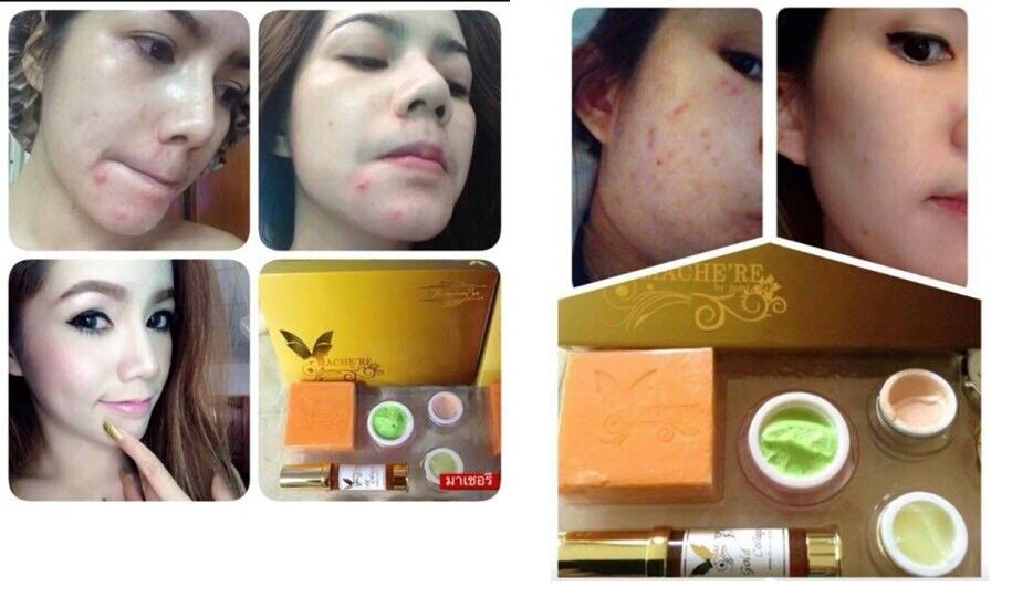 Mache're Gold Whitening Cream Perfect Set Bright Smooth Skin Face Care