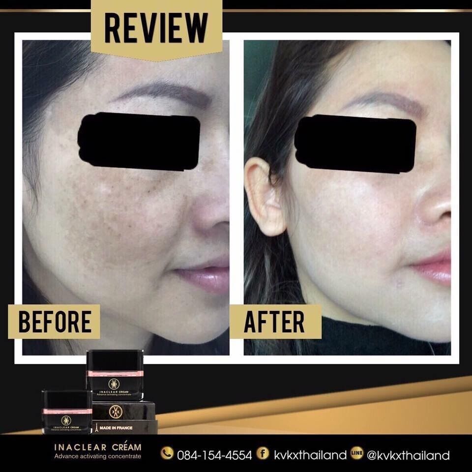 Inaclear Cream Serum Pico Lotion Reveal bright soft moist skin dark spots fade