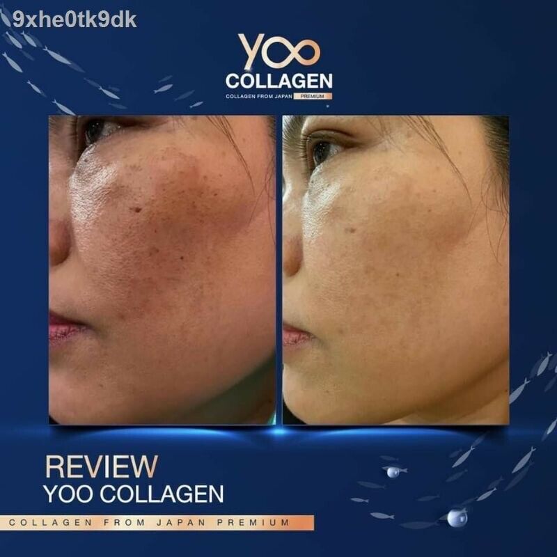 110,000mg Yoo Collagen Premium Grade 4 Type Japan Joint Skin Soften Anti-Wrinkle