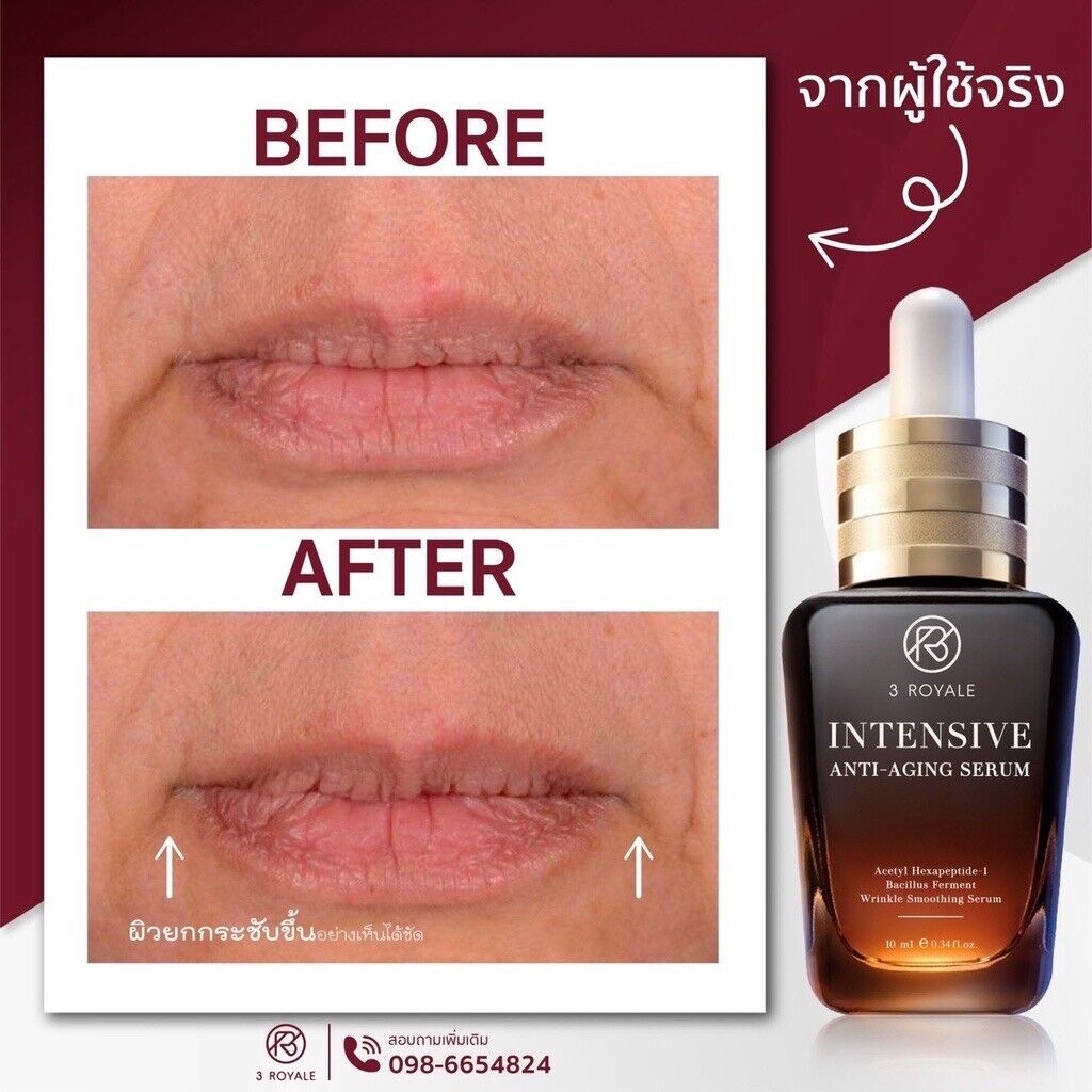 4x Botox Serum 3Royale Intensive Anti-Aging Reduce Wrinkles lift V-Shape 10ml