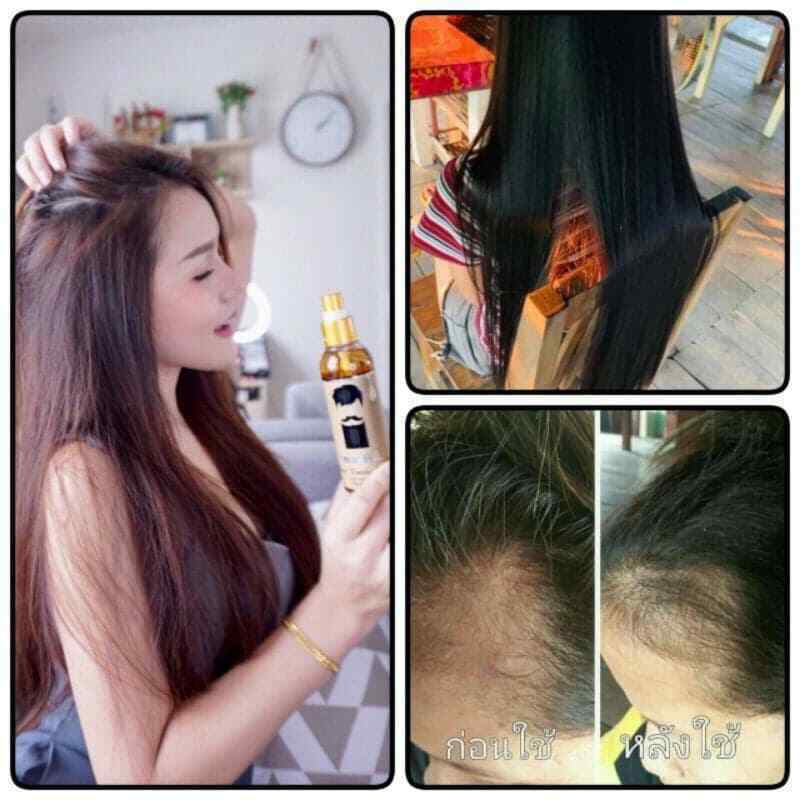 120ml LEGANO Hair Tonic Reduce Hair Loss Fast Growth Herbal Nature Treatment x 3