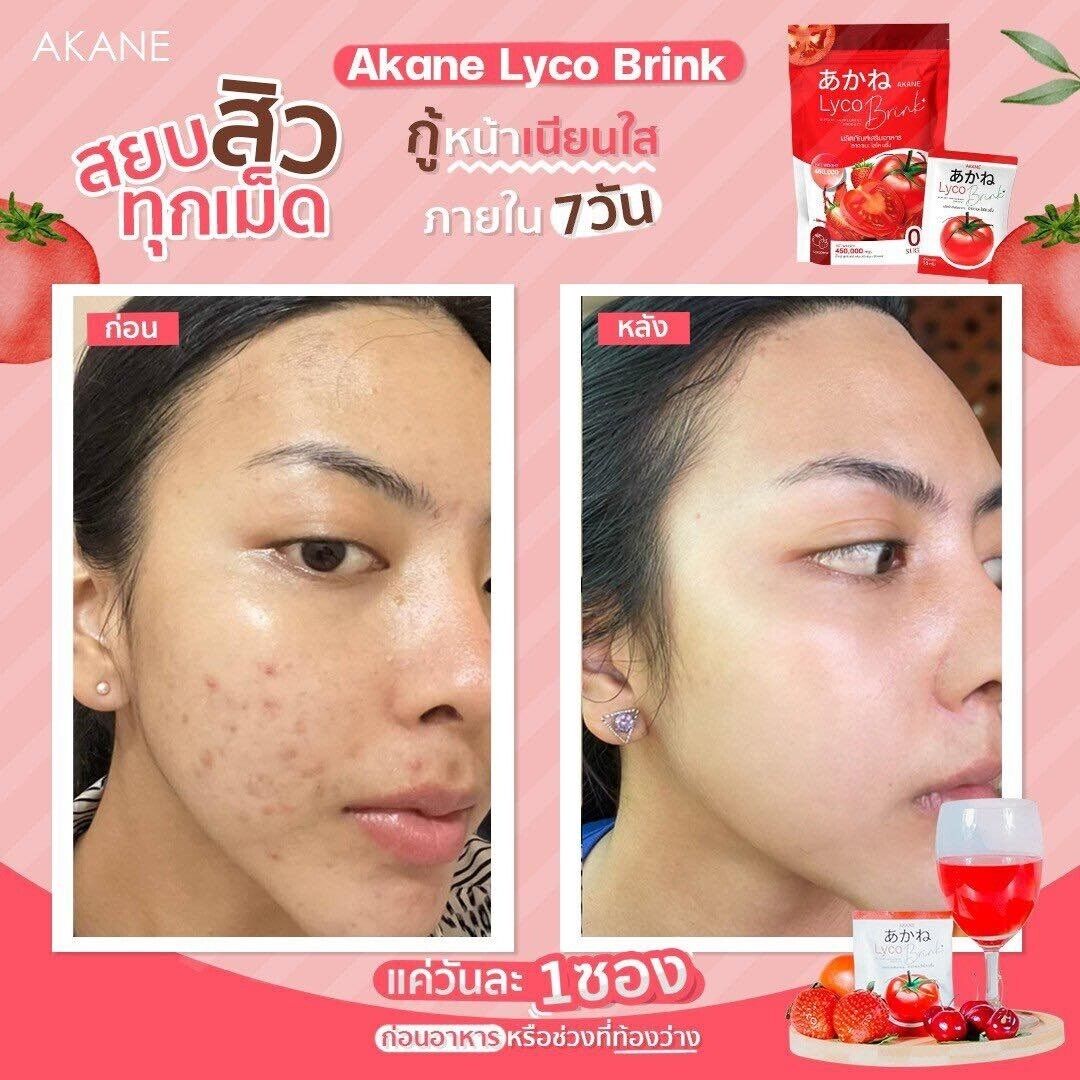 3x Akane Lyco Brink Tomato Powder Drink Bright skin moist, dark spots fade
