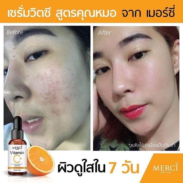 2X Mercy Vitamin C Serum Whitening Facial Anti Aging Skin Brightening Smooth