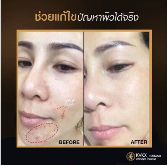 Inaclear Face Cream rejuvenate Skin Healthy Smooth dark spots fade white clear