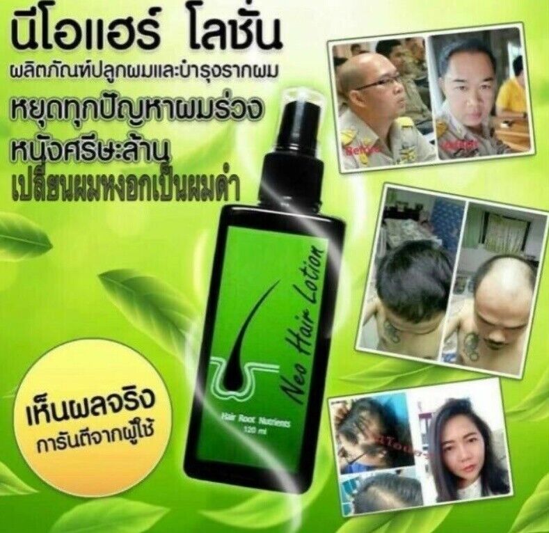 8x Neo Hair Lotion Green Wealth Growth Root Nutrients Hair Loss Treatments Herbs