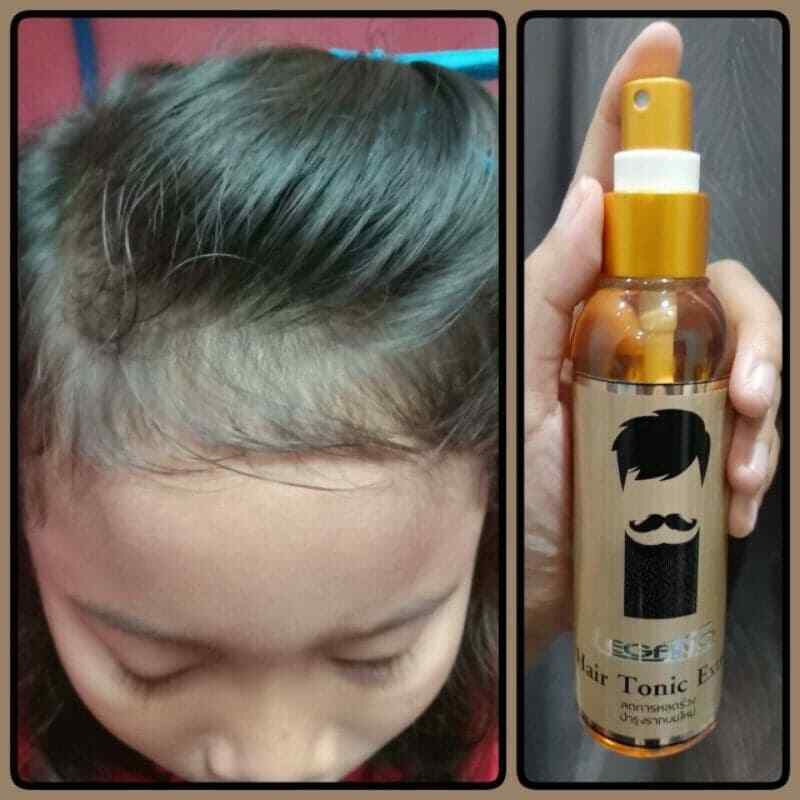 120ml LEGANO Hair Tonic Reduce Hair Loss Fast Growth Herbal Nature Treatment x 3