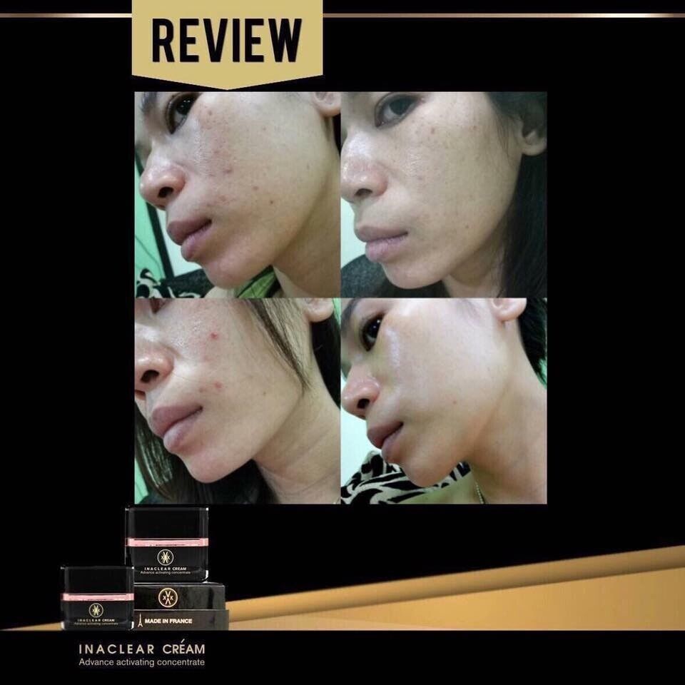 Inaclear Cream Serum Pico Lotion Reveal bright soft moist skin dark spots fade
