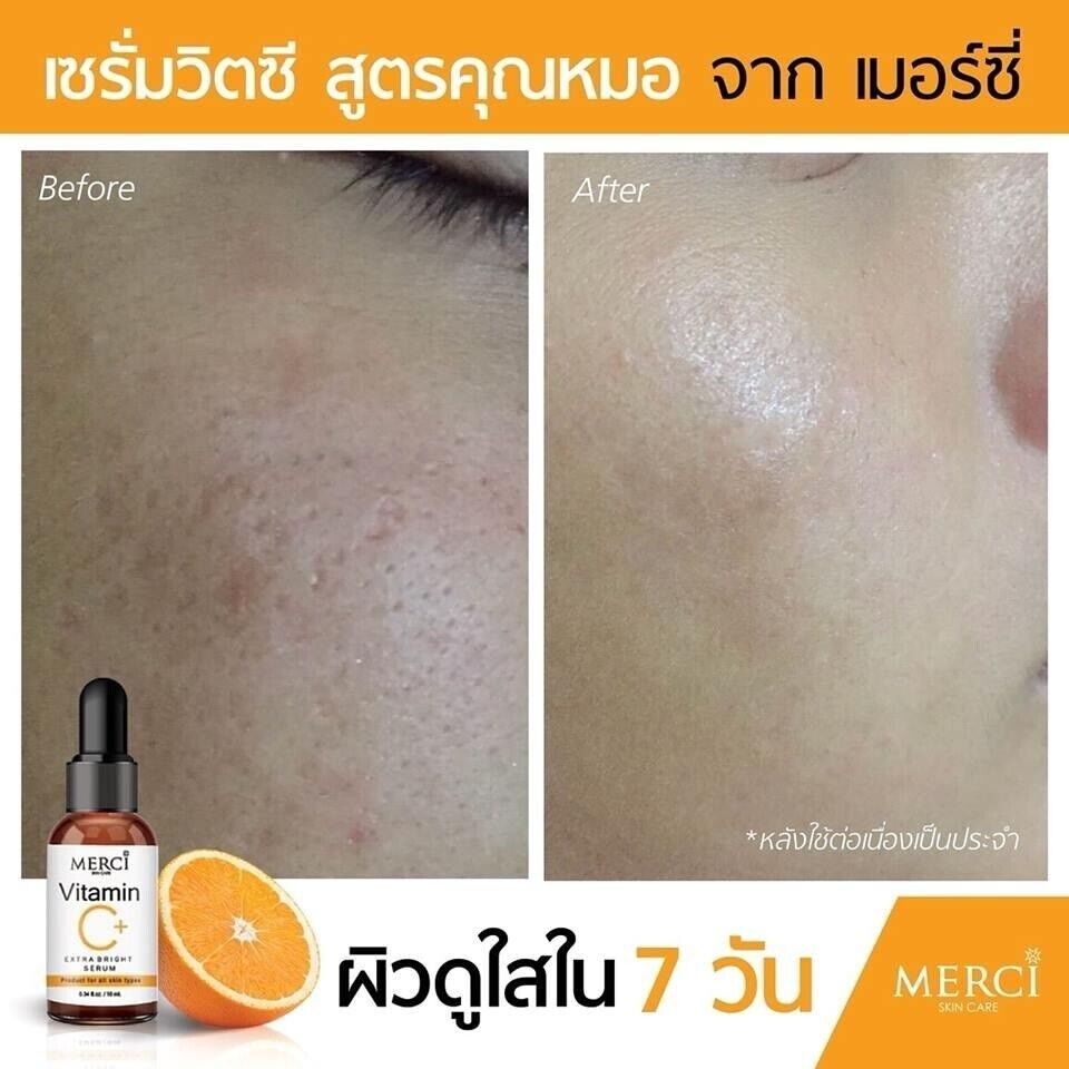2X Mercy Vitamin C Serum Whitening Facial Anti Aging Skin Brightening Smooth