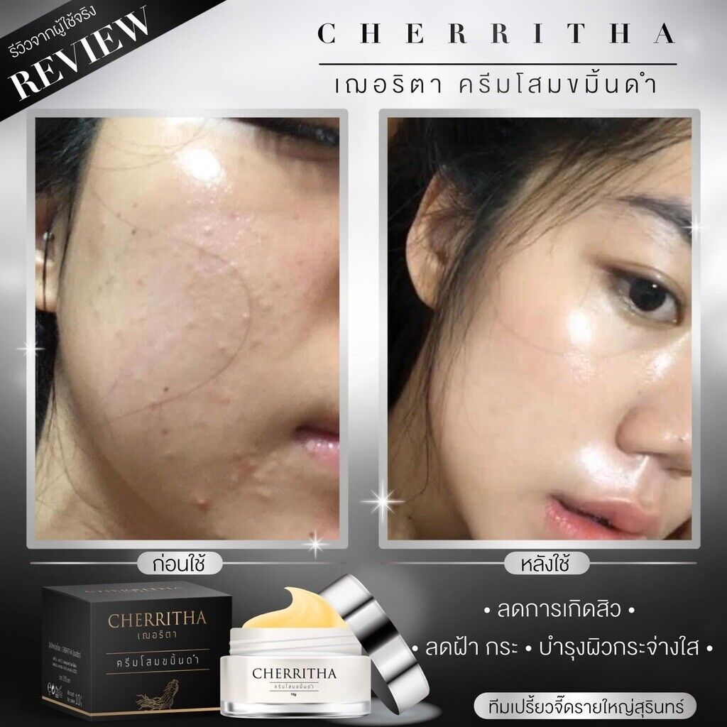 Charitha Day & Night Cream Aloe Vera Turmeric Ginseng revive healthy skin