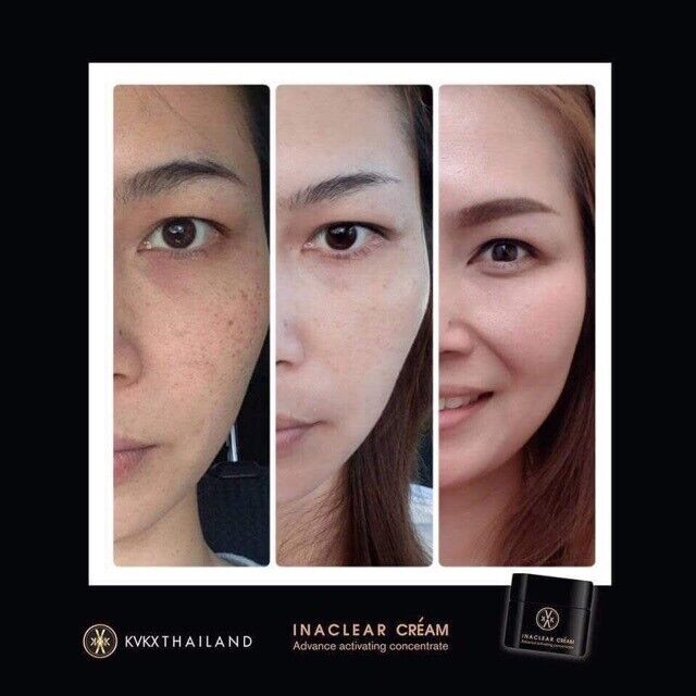 Inclear Cream & Serum Skin radiance wrinkles dark spots fade smooth pores