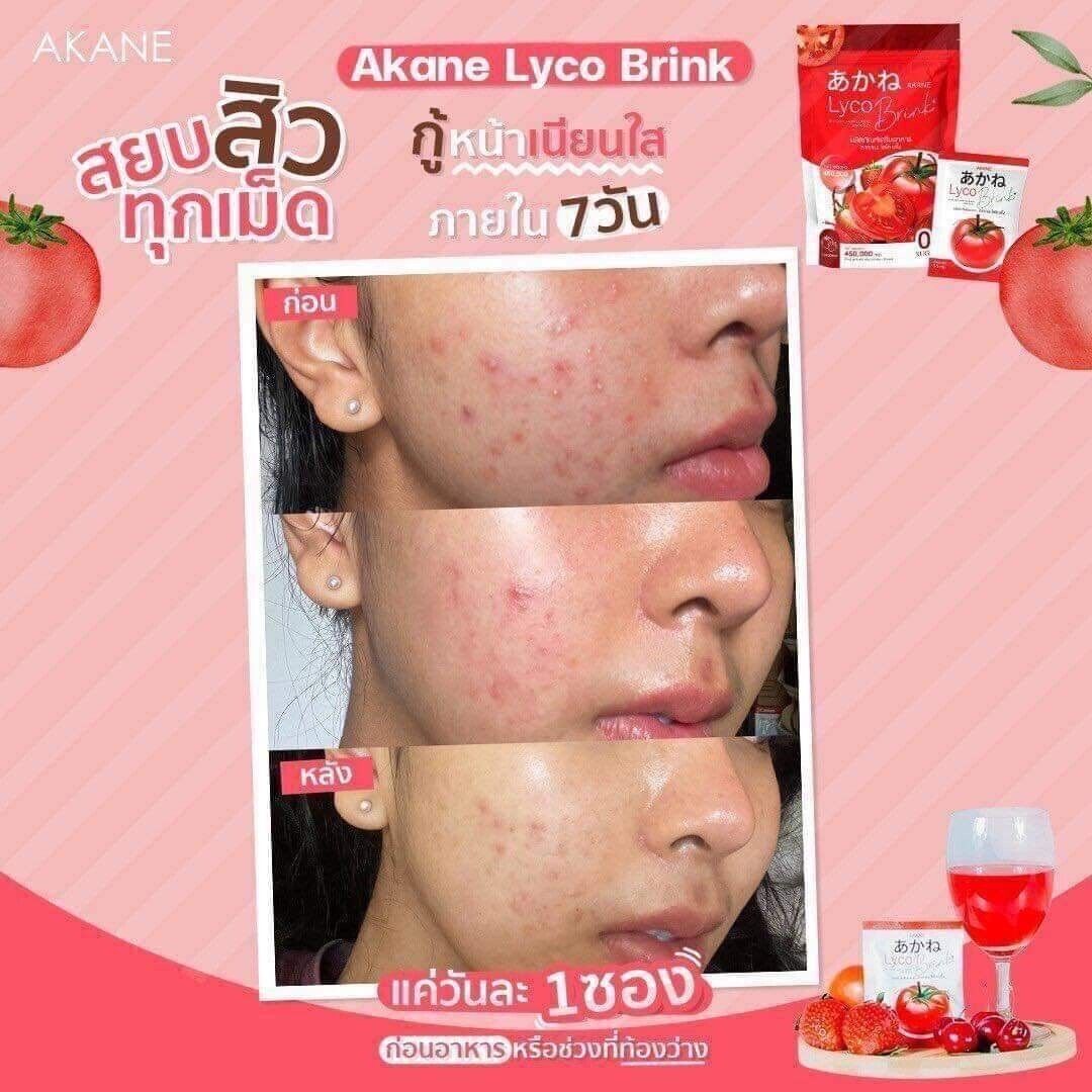 3x Akane Lyco Brink Tomato Powder Drink Bright skin moist, dark spots fade