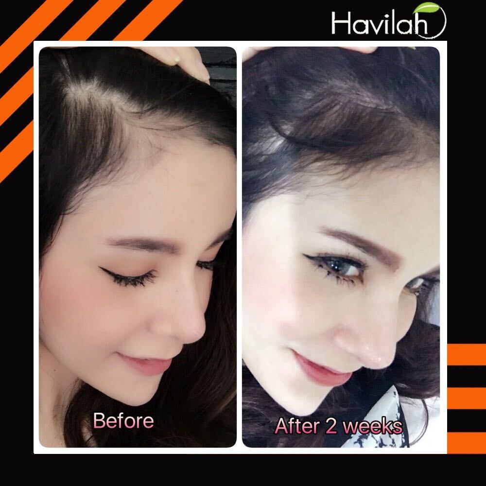 100% Herbal Havilah Shampoo Hair Loss Protection Transplant Accelerate Long Hair