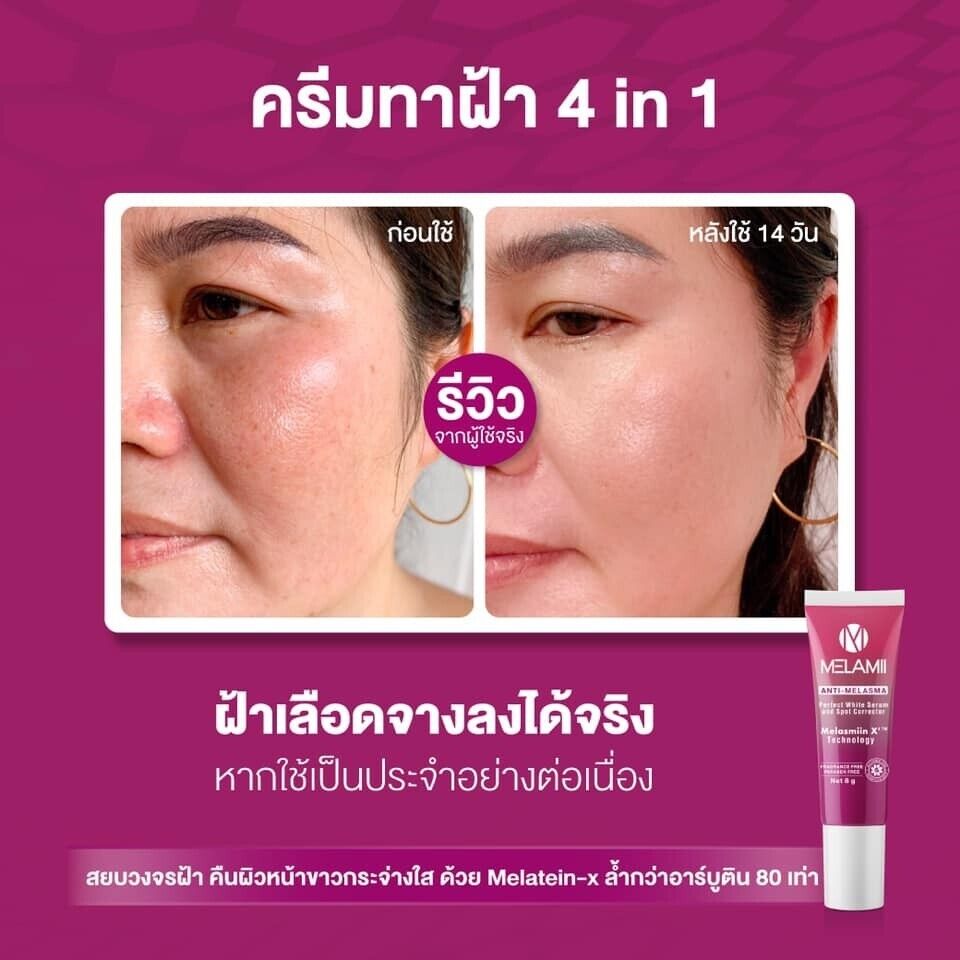 Melamii Anti-Melasma cream reduce dark spots white serum skin
