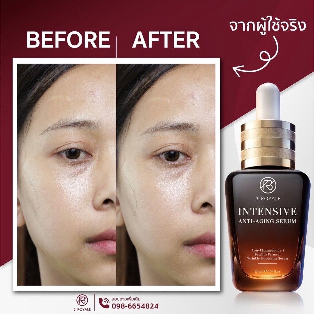 4x Botox Serum 3Royale Intensive Anti-Aging Reduce Wrinkles lift V-Shape 10ml