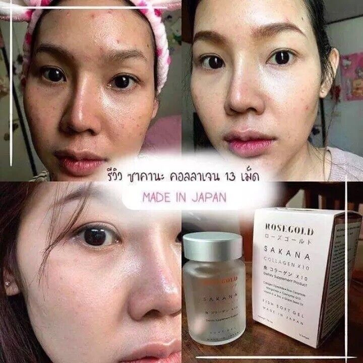 Rose Gold 10X Collagen 7 days Smooth Skin Clear Bright AcneRestore Rejuvenation