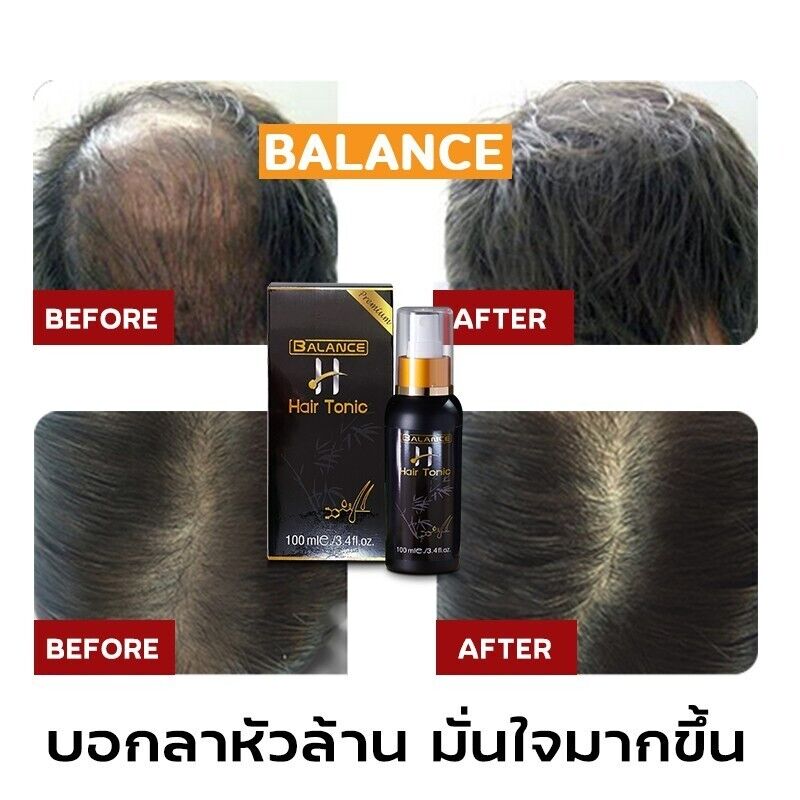 BALANCE H HAIR TONIC SERUM Regrowth Create New Hair Black Thicker 100ml