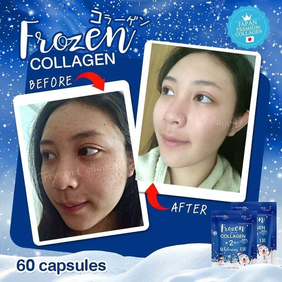 10X 60 Caps Frozen Collagen 2in1 Supplement Vitamin Nourish Skin Hair Bone Nails