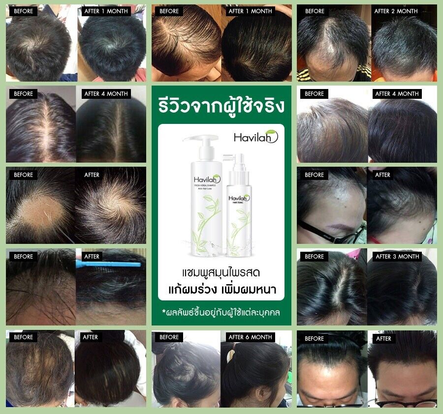 Promotion Set C3 Havilah Hair Loss & Hair Growth Care Shampoo Conditioner Tonic