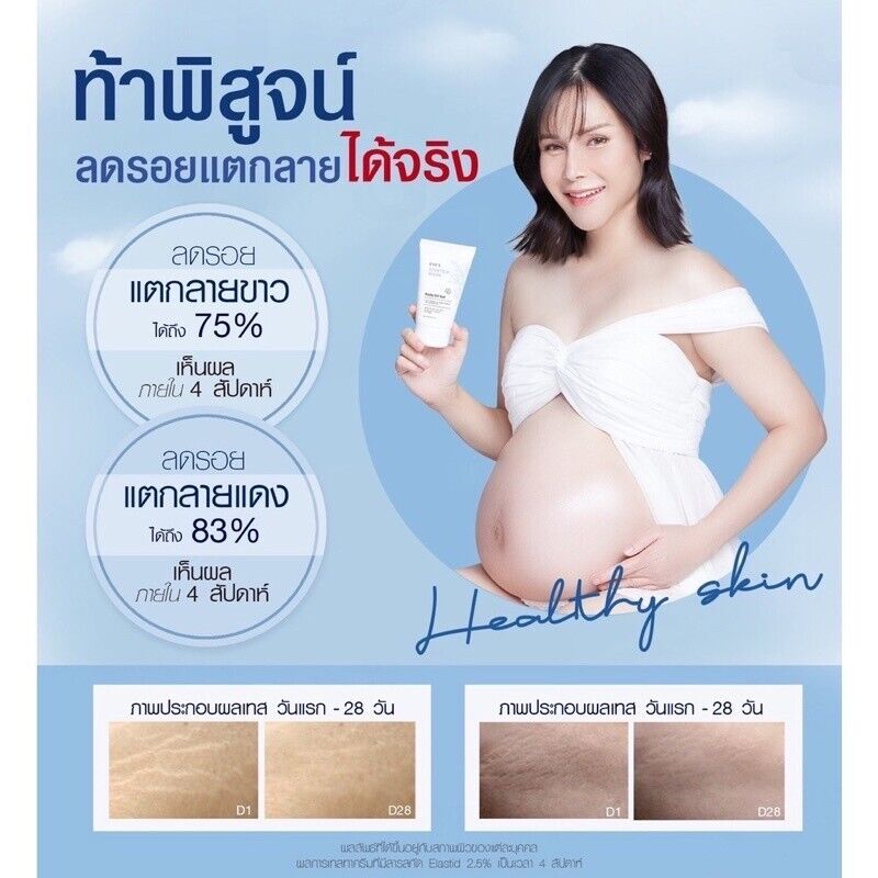 4x EVE'S Stretch Mark Body Oil Gel Reduce Blemishes Scars Cracks Dry Skin 90 g