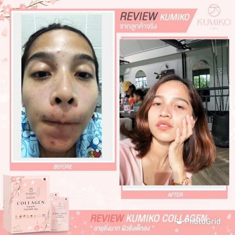 10x KUMIKO Collagen Natural Ingredients Anti-Aging Skincare Smooth Radiance Skin