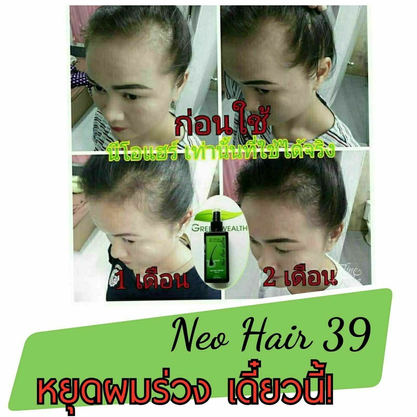 1X 120 ml. Green Wealth Neo Hair Lotion Root Nutrients Hair Loss Treatments