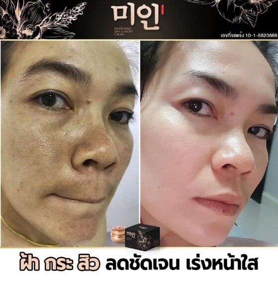 Korean pearl cream ?? Skin rejuvenation Reduce black spots Facial cream 5g