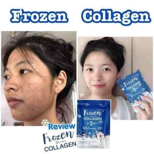 10X 60 Caps Frozen Collagen 2in1 Supplement Vitamin Nourish Skin Hair Bone Nails