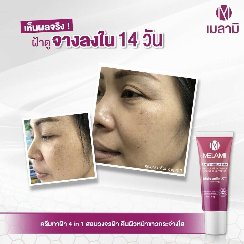 Melamii Anti-Melasma cream reduce dark spots white serum skin