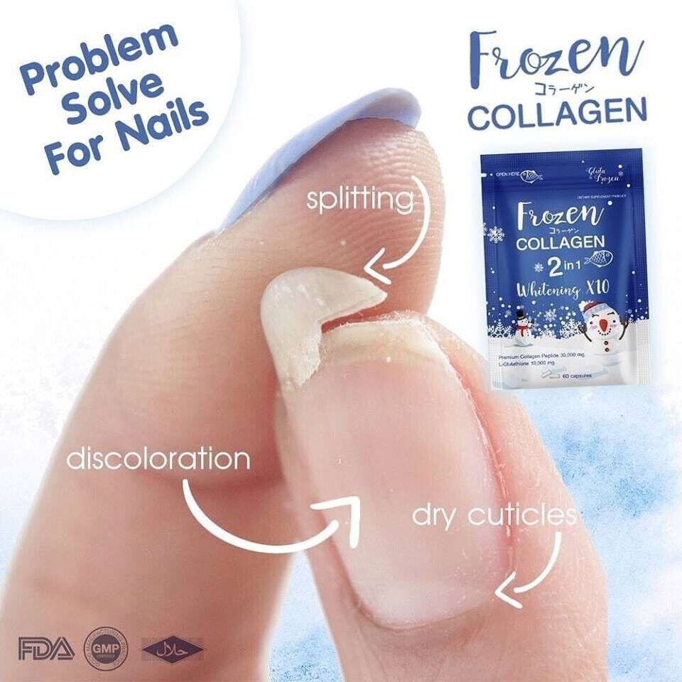 10X 60 Caps Frozen Collagen 2in1 Supplement Vitamin Nourish Skin Hair Bone Nails