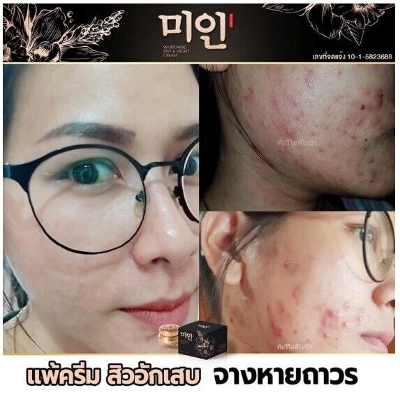 Korean pearl cream ?? Skin rejuvenation Reduce black spots Facial cream 5g