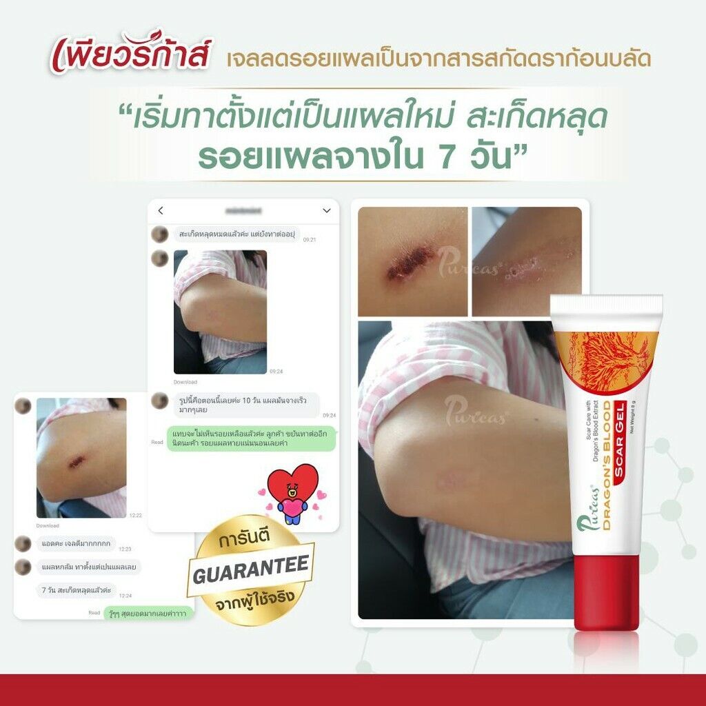 8g Puricas Dragon's Blood Scar Gel Treat Keloid, Surgery, Acne Scars, Dark spots
