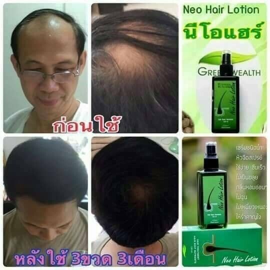 6x Neo Hair Lotion Root Treatment Nutrients for Loss Hair, Longer Hair 120 ml