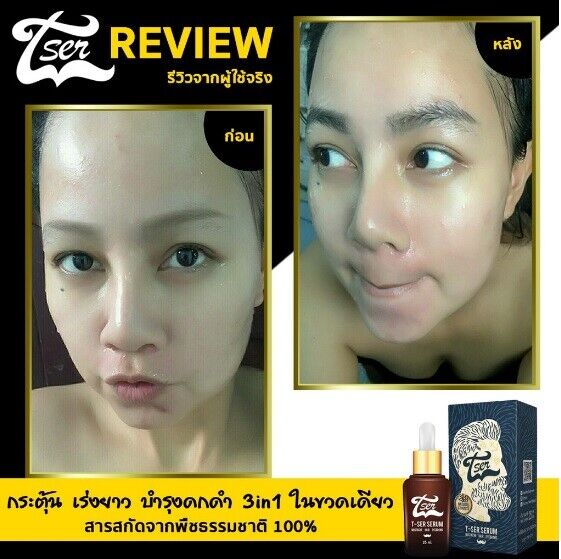 12X T-Ser Serum Nourish Growth Hair Eyebrows Mustache Beard Thicker Natural 100%