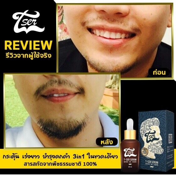 12X T-Ser Serum Nourish Growth Hair Eyebrows Mustache Beard Thicker Natural 100%