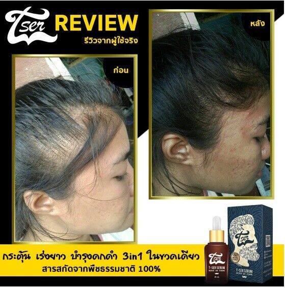 12X T-Ser Serum Nourish Growth Hair Eyebrows Mustache Beard Thicker Natural 100%
