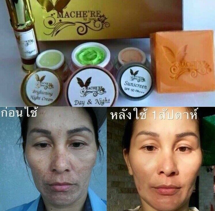 Mache're Gold Whitening Cream Perfect Set Bright Smooth Skin Face Care