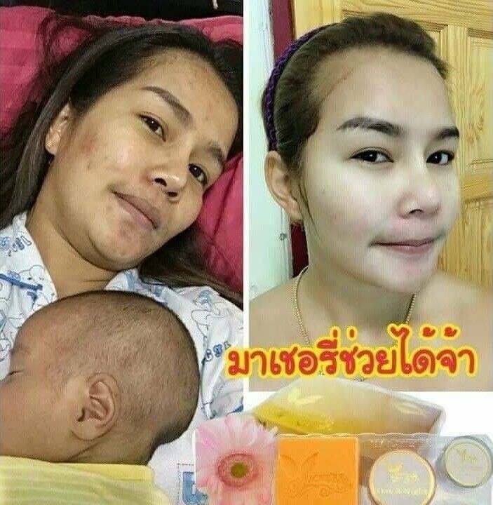 Mache're Gold Whitening Cream Perfect Set Bright Smooth Skin Face Care