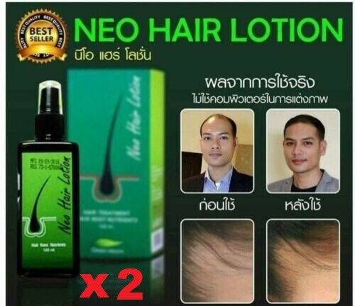 2X120ml Green Wealth Neo Hair Lotion Growth Root Hair Loss Nutrients Treatments
