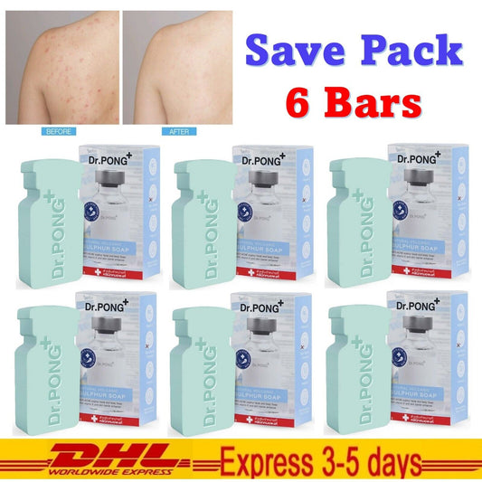 6x Dr. PONG Natural Volcanic Sulfur Soap Gentle For People With Acne Prone 70g