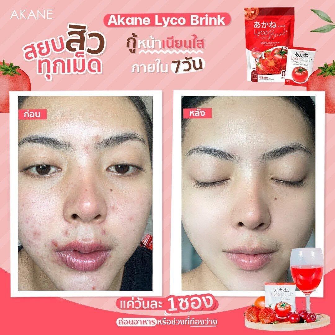 3x Akane Lyco Brink Tomato Powder Drink Bright skin moist, dark spots fade
